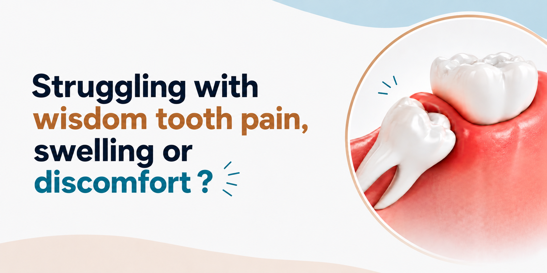 Is Wisdom Tooth Extraction Painful? How Modern Dentistry Makes It Comfortable