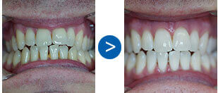 mysmiledoctor teeth1
