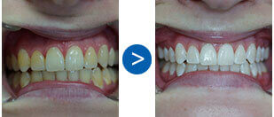 mysmiledoctor teeth2